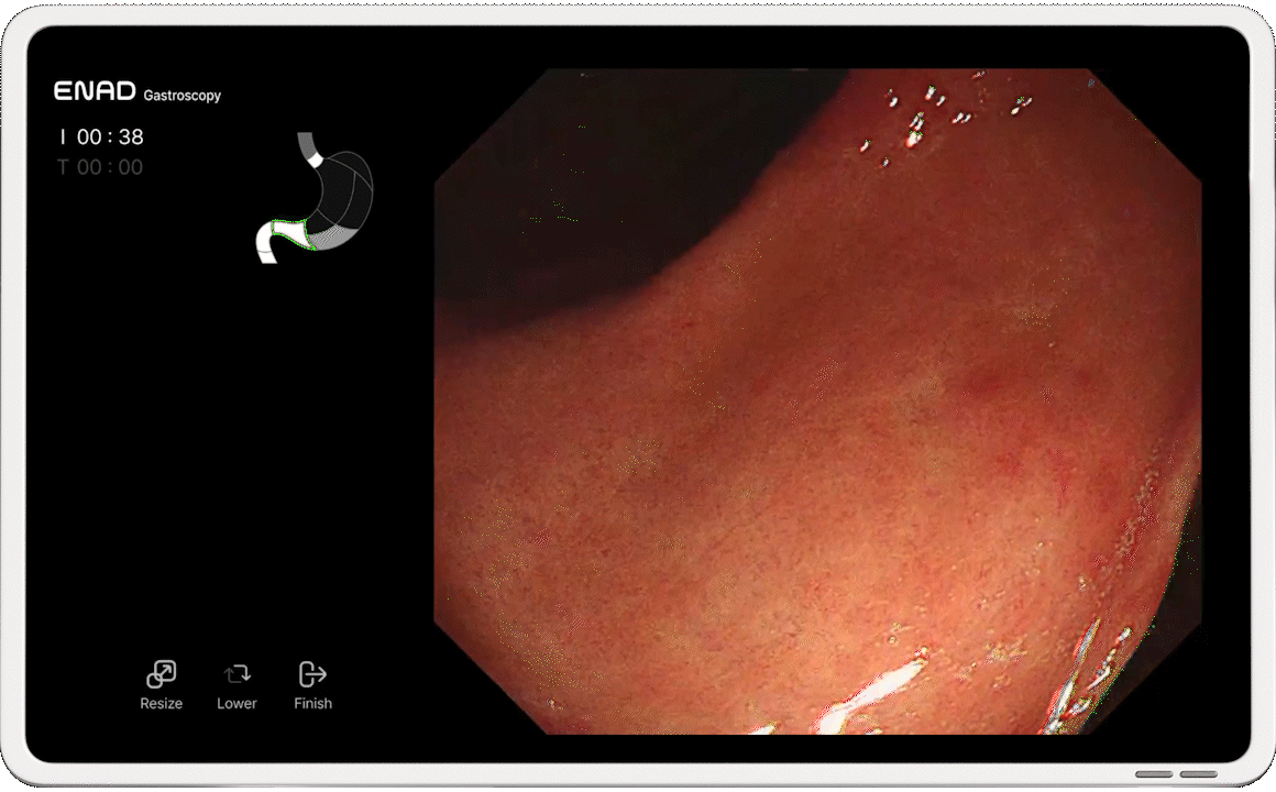 Polyp detection AI software ENAD