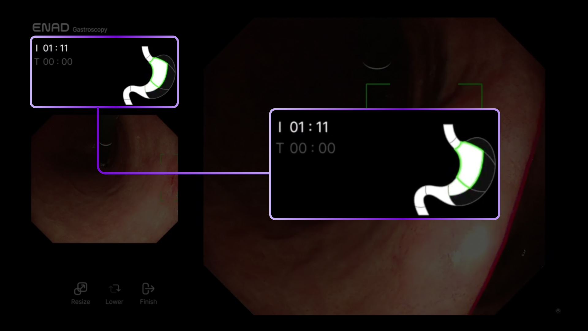 ENAD serparately tracks procedure and treatment duration automatically