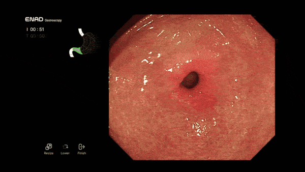 ENAD examines the gastro by dividing into 10 sections